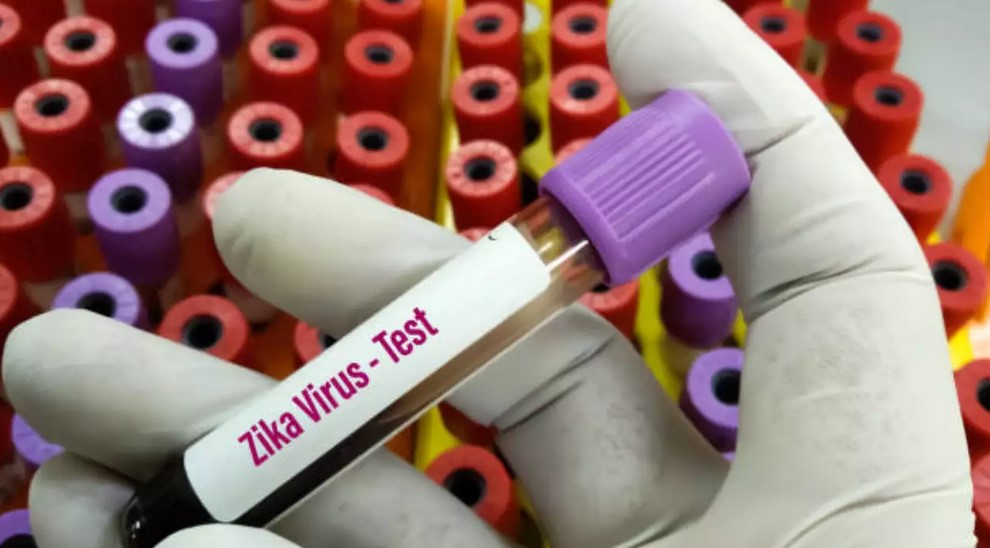 zika-virus-health